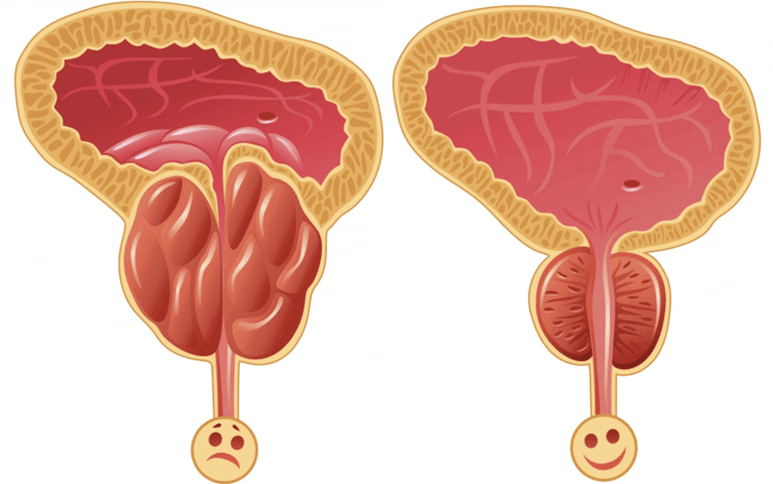 տղամարդկանց մոտ պոտենցիայի խնդիրների պատճառները